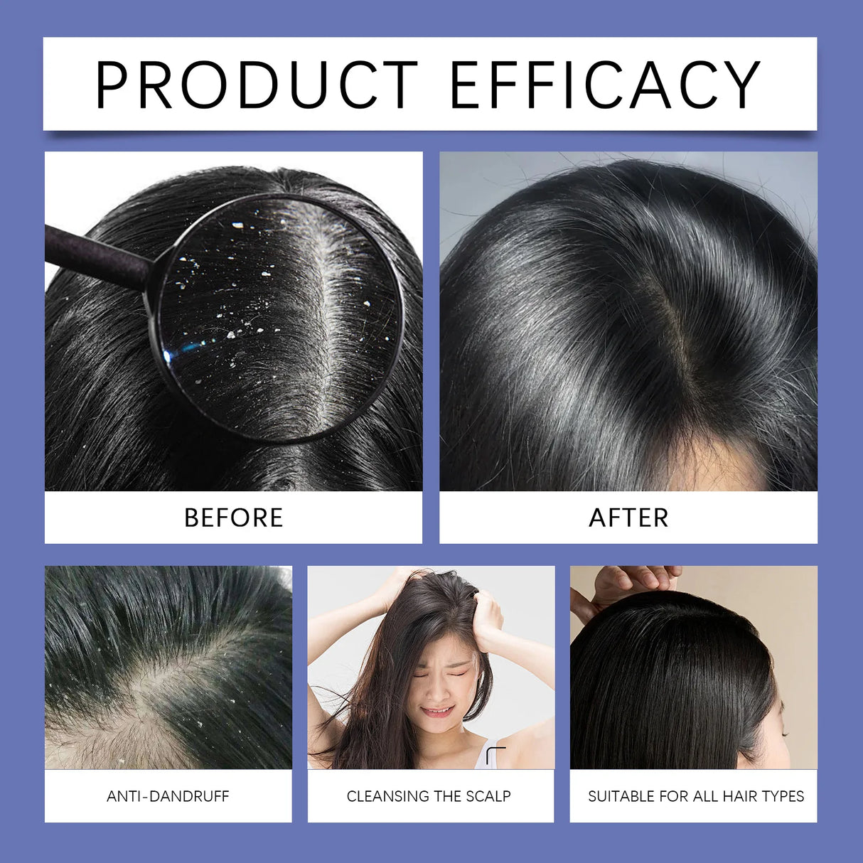 Selenium Sulfide Shampoo 8oz Deep Cleansing Dandruff Treatment
