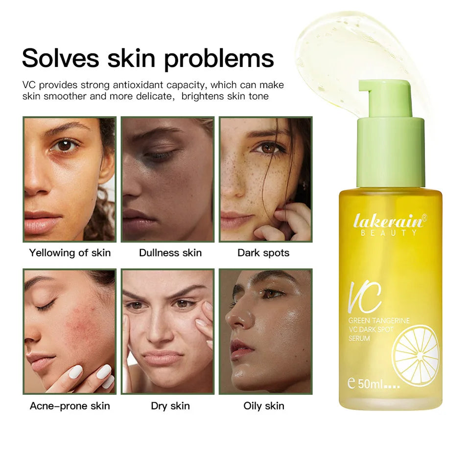 Vitamin C Serum 50ml | Dark Spot Care | Brightening Facial Essence