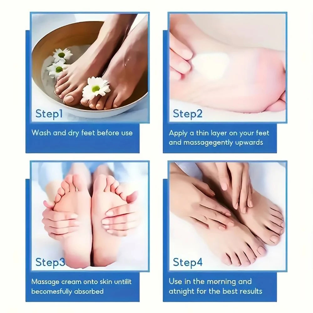 Urea Foot Cream 60% - Intensive Moisturizing Treatment for Cracked Heels