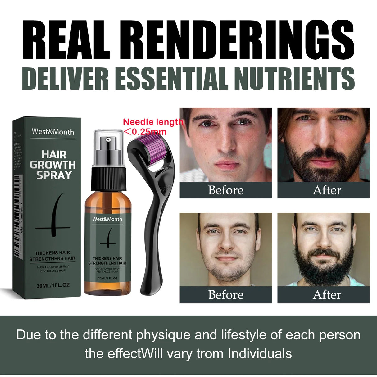 Men's Beard Spray Kit with Micro Roller 0.25mm Moisturizing Essence