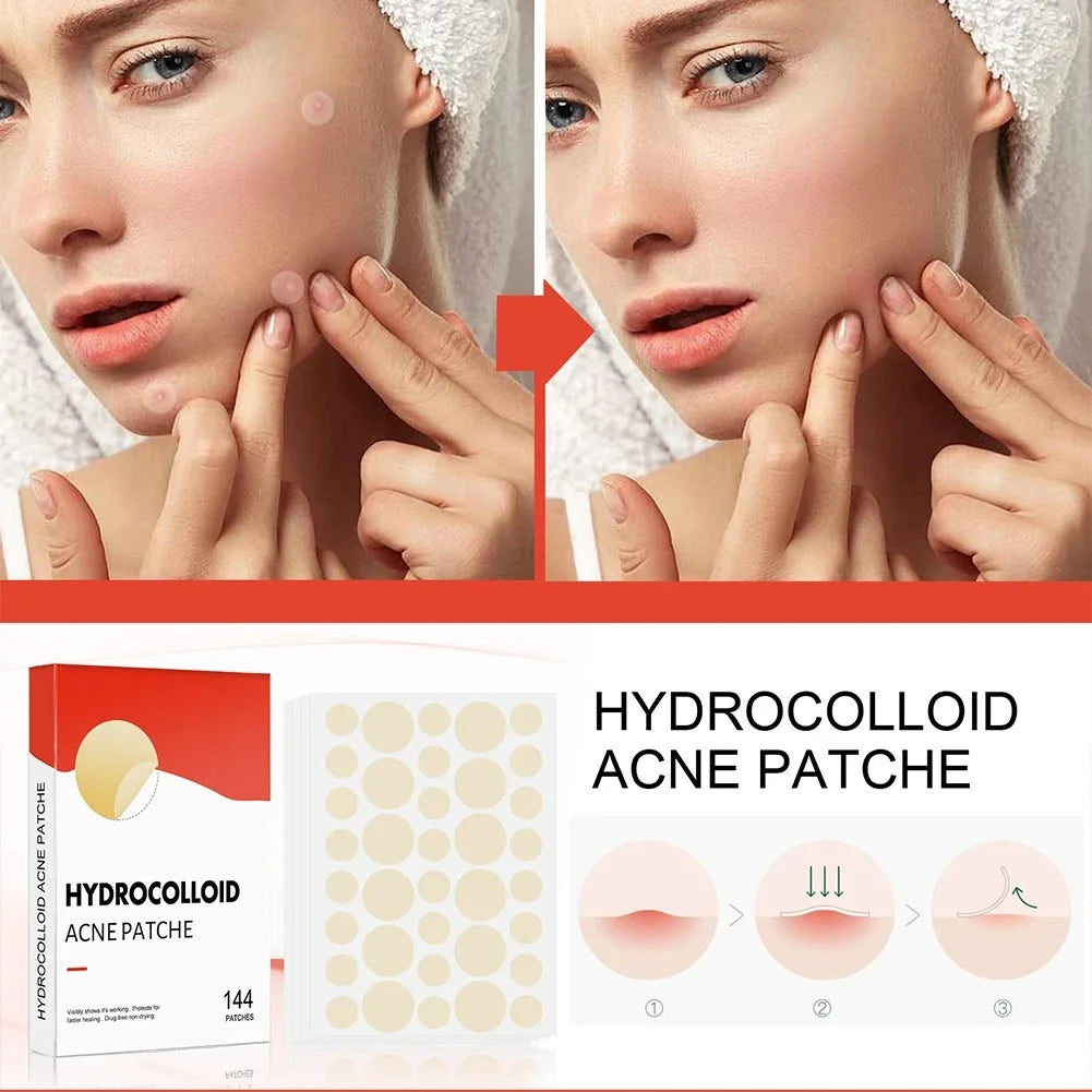 144pcs Acne Patches for Spot Treatment, Invisible Healing Stickers