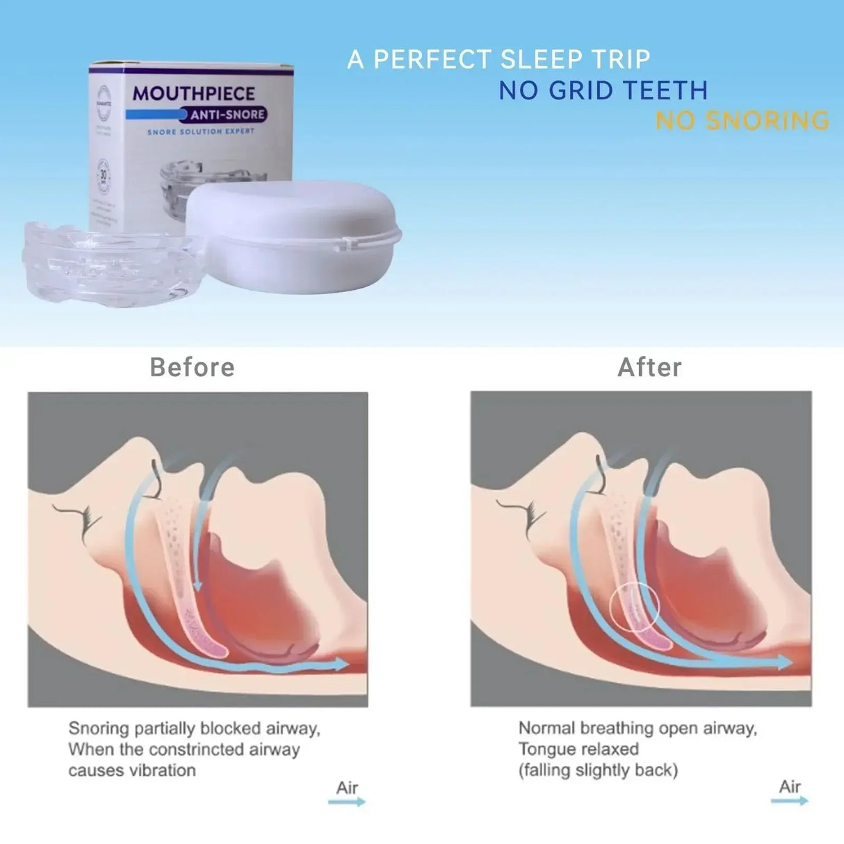 Adjustable Anti-Snoring Mouth Guard Device for Bruxism Sleep Improvement