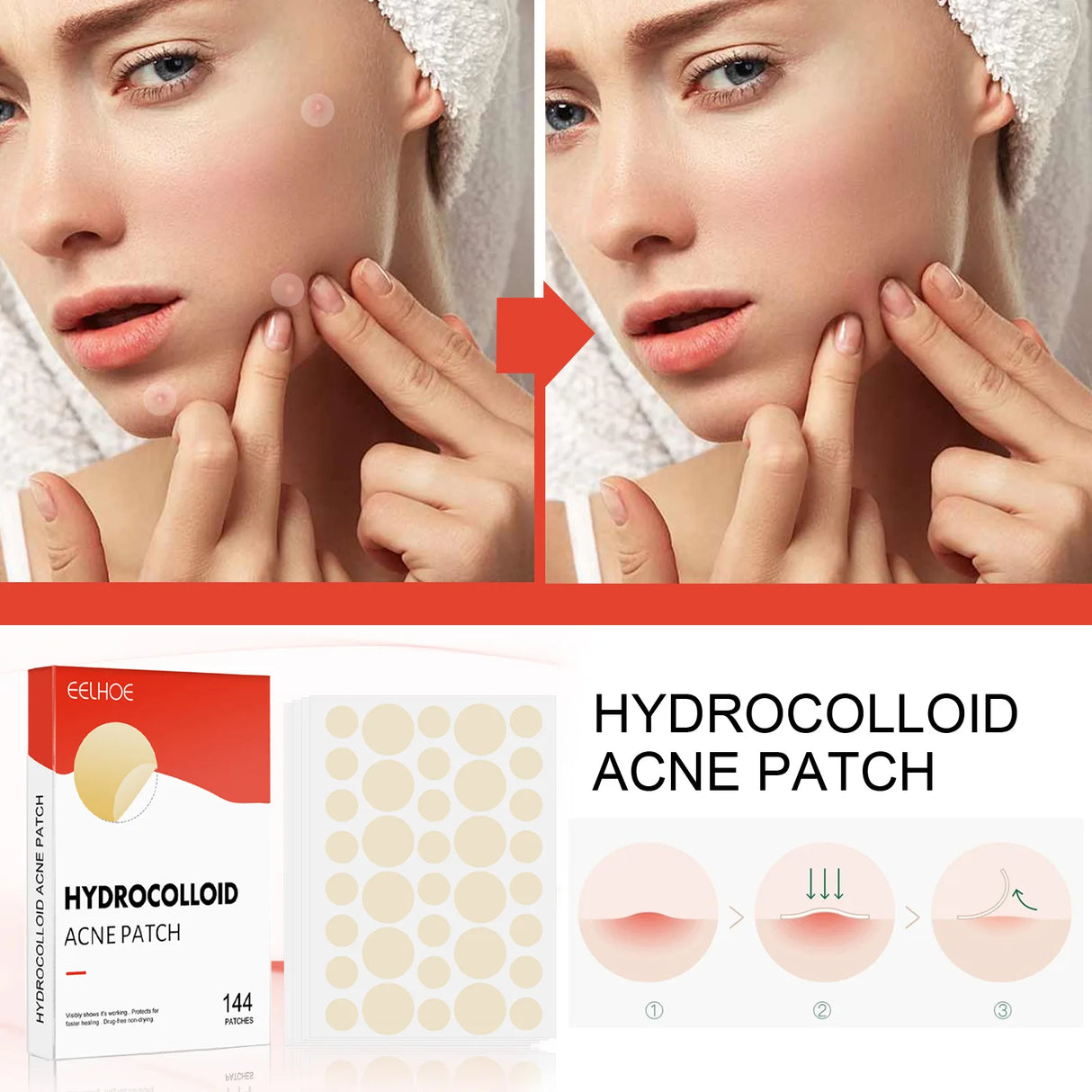 144pcs Acne Patches for Spot Treatment, Invisible Healing Stickers