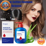 Selenium Sulfide Shampoo for Dandruff Relief and Hair Strength