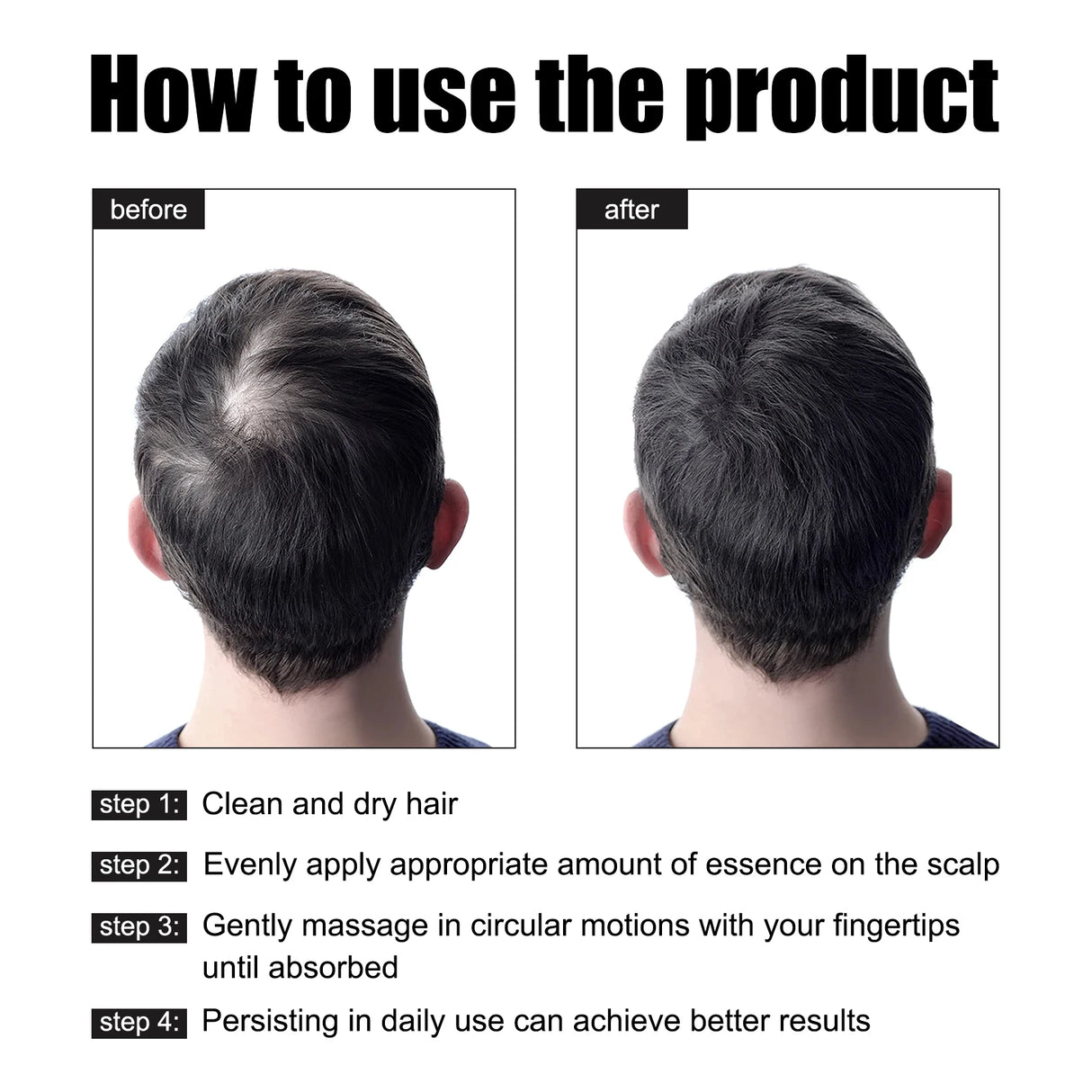 Men's Hair Essence 30ml - Nourishing & Moisturizing Scalp Treatment