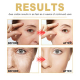 Golden Age Essence 30ml for Hydration and Skin Tightening