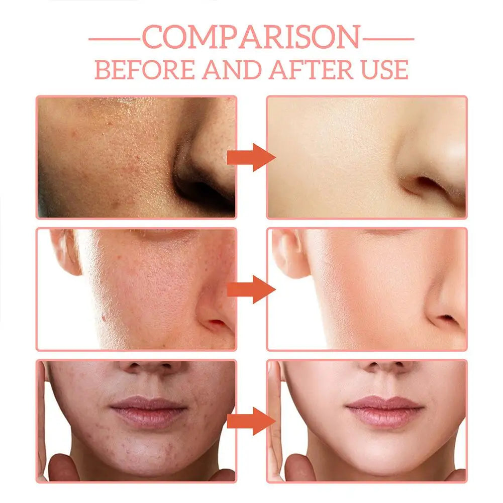 5-in-1 Facial Serum with Vitamin C and Hyaluronic Acid, 30ml