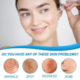 Hyaluronic Acid Serum 30ML - Lifting & Firming for Fine Lines & Dark Circles