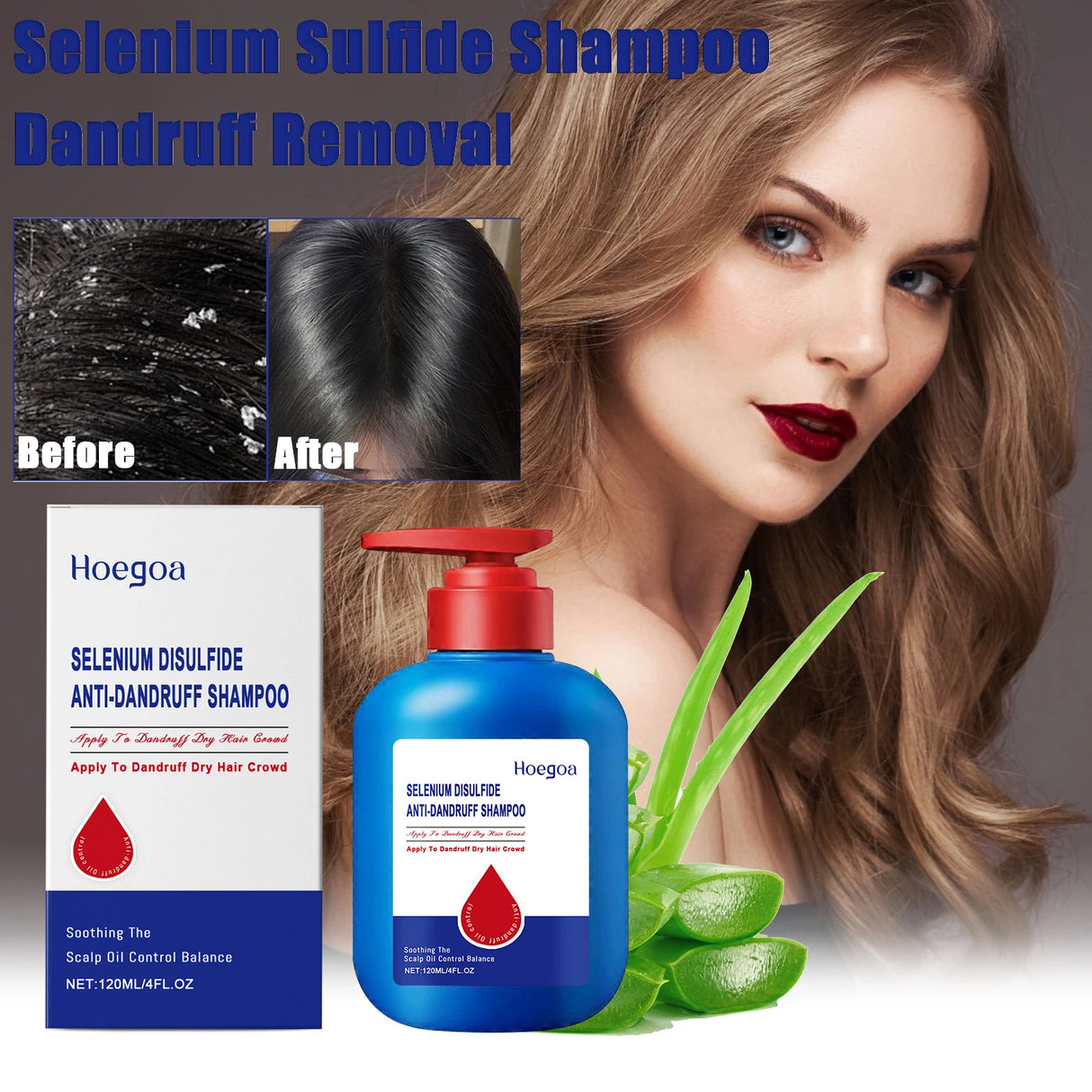Selenium Sulfide Shampoo 8oz Deep Cleansing Dandruff Treatment