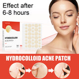 144pcs Acne Patches for Spot Treatment, Invisible Healing Stickers