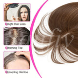 Human Hair Toppers for Women, 5x9cm Clip-in Hairpieces for Volume