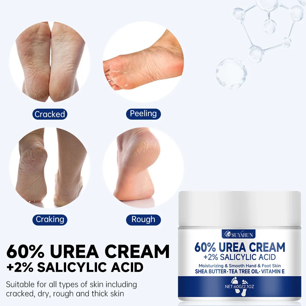 Urea Foot Cream 60% - Intensive Moisturizing Treatment for Cracked Heels