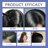 Selenium Sulfide Shampoo 8oz Deep Cleansing Dandruff Treatment