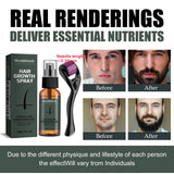 Men's Beard Spray Kit with Micro Roller 0.25mm Moisturizing Essence