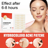 144pcs Acne Patches for Spot Treatment, Invisible Healing Stickers