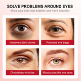 Retinol Eye Cream for Dark Circles and Firming Skin, 15g