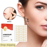 144pcs Acne Patches for Spot Treatment, Invisible Healing Stickers