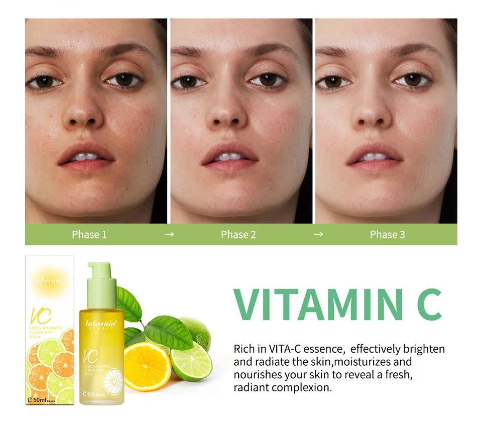 Vitamin C Serum 50ml | Dark Spot Care | Brightening Facial Essence