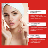 240pcs Star Acne Patches Invisible Pimple Cover Oil Control Spot Treatment