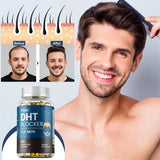 DHT Blockers for Men - Saw Palmetto & Biotin for Hair Growth Support