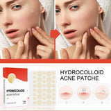 144pcs Acne Patches for Spot Treatment, Invisible Healing Stickers