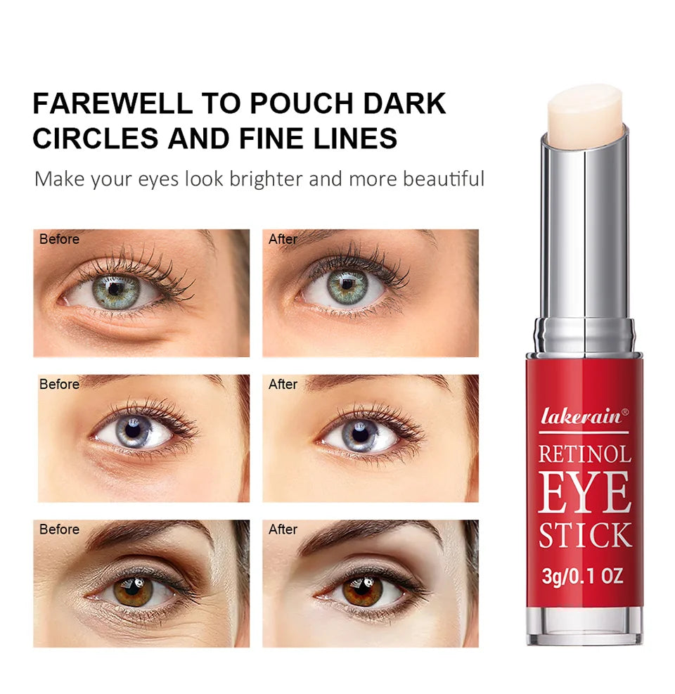Retinol Eye Cream for Dark Circles and Firming Skin, 15g