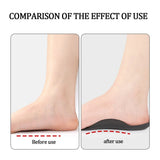 Arch Support Insoles 2-Pack – Half Orthotics for Running & Work Shoes