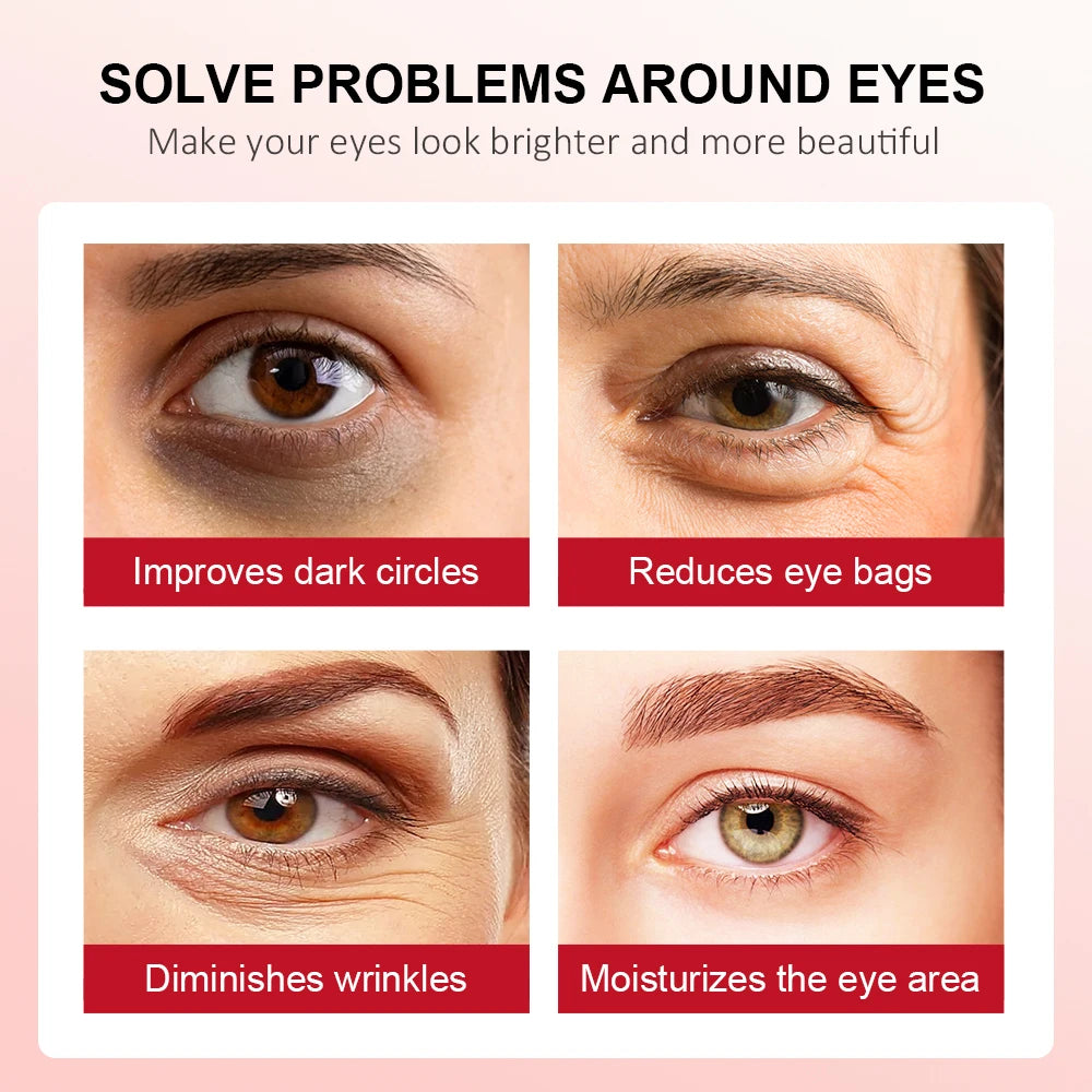 Retinol Eye Cream for Dark Circles and Firming Skin, 15g