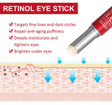 Retinol Eye Cream for Dark Circles and Firming Skin, 15g